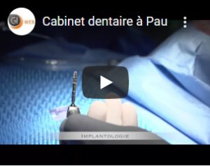 Cabinet dentaire à Pau