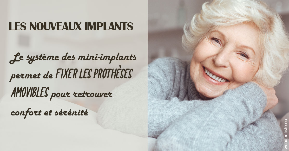 https://dr-muffat-jeandet-julien.chirurgiens-dentistes.fr/Les nouveaux implants 1