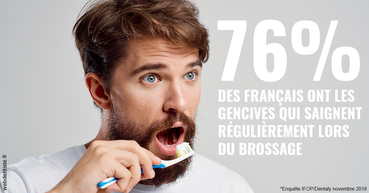 https://dr-muffat-jeandet-julien.chirurgiens-dentistes.fr/76% des Français 2