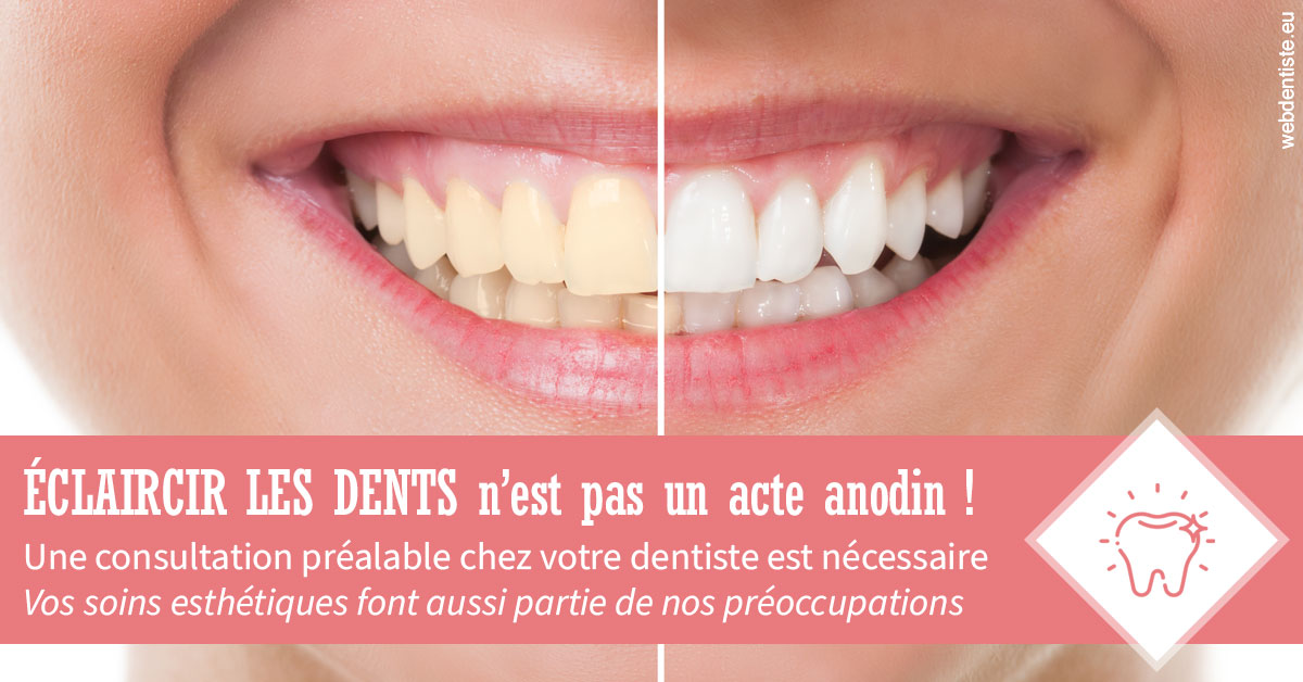 https://dr-muffat-jeandet-julien.chirurgiens-dentistes.fr/Eclaircir les dents 1