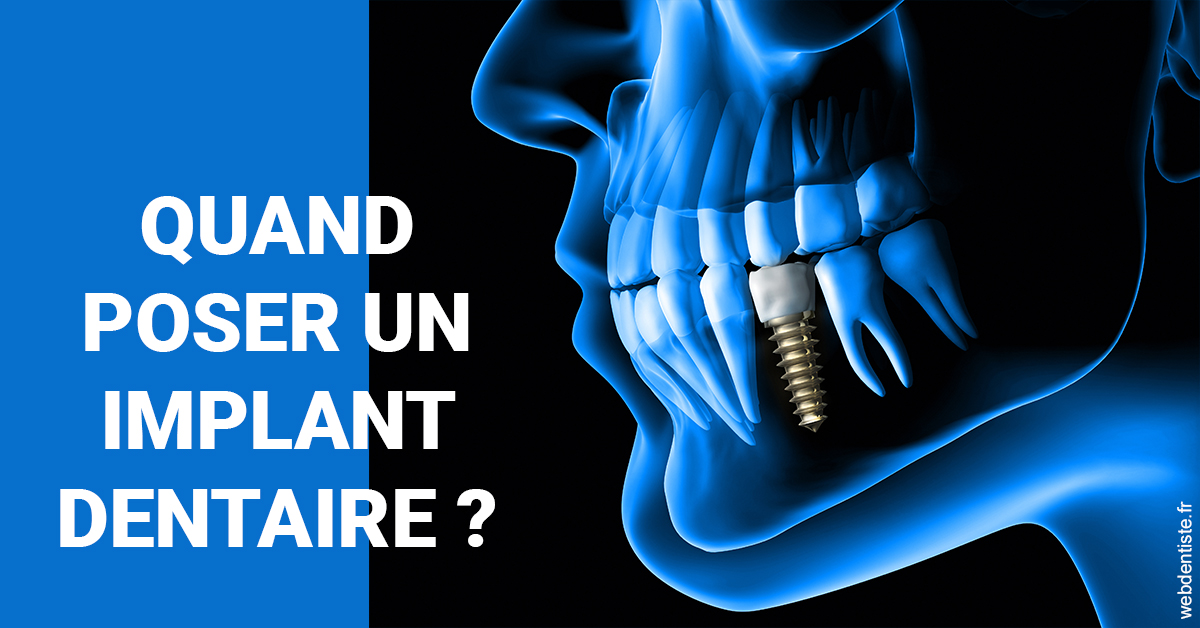 https://dr-muffat-jeandet-julien.chirurgiens-dentistes.fr/Les implants 1