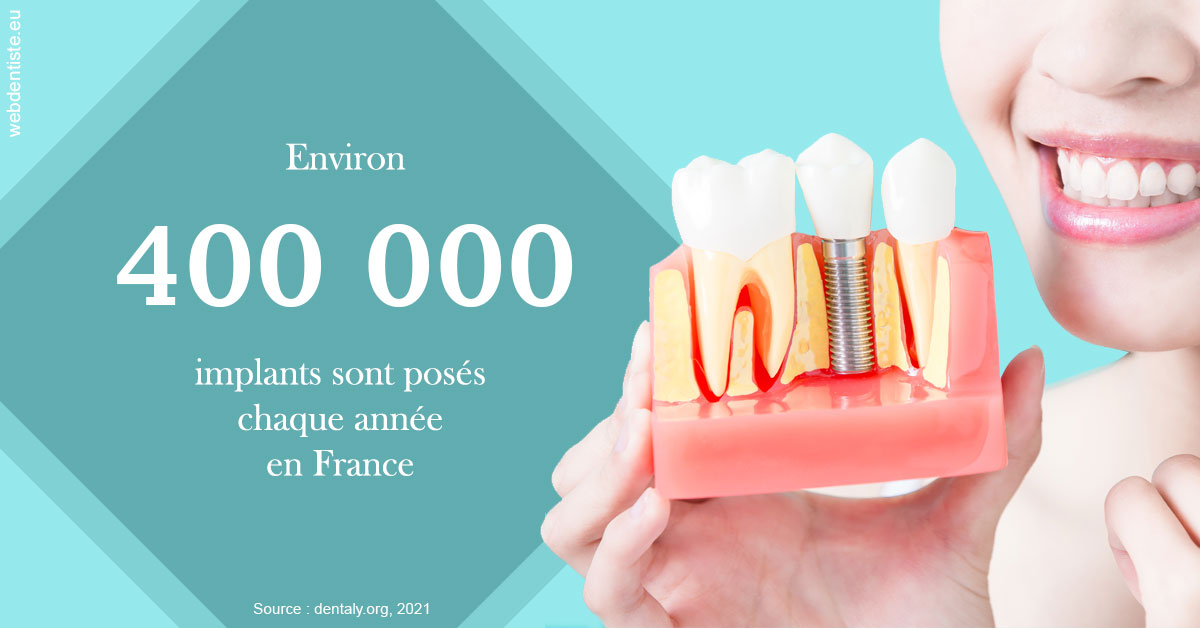 https://dr-muffat-jeandet-julien.chirurgiens-dentistes.fr/Pose d'implants en France 2