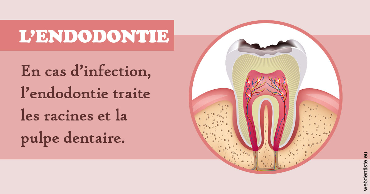 https://dr-muffat-jeandet-julien.chirurgiens-dentistes.fr/L'endodontie 2